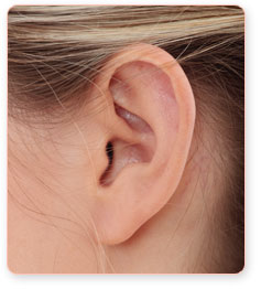Ear Pinning Female Cosmetic Plastic Surgeon, Chicago, Glenview, Highland Park, North Shore, Liposuction, Breast Augmentation, Breast Implants, Breast Enhancement, Facelift, Tummy Tucks, Best Plastic Surgeons, Cosmetic Surgery, Botox, laser lipo, Cellulaze, Coolsculpting, Smartlipo, Fat reduction, www.casas.md Ear Pinning Female Cosmetic Plastic Surgeon, Chicago, Glenview, Highland Park, North Shore, Liposuction, Breast Augmentation, Breast Implants, Breast Enhancement, Facelift, Tummy Tucks, Best Plastic Surgeons, Cosmetic Surgery, Botox, laser lipo, Cellulaze, Coolsculpting, Smartlipo, Fat reduction, www.casas.md
