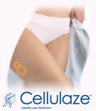 Cellulaze, Cellulite, Fat reduction, Facial Fillers, Skin, Chicago, Glenview, North Shore,  Cosmetic Surgery, Plastic Surgery