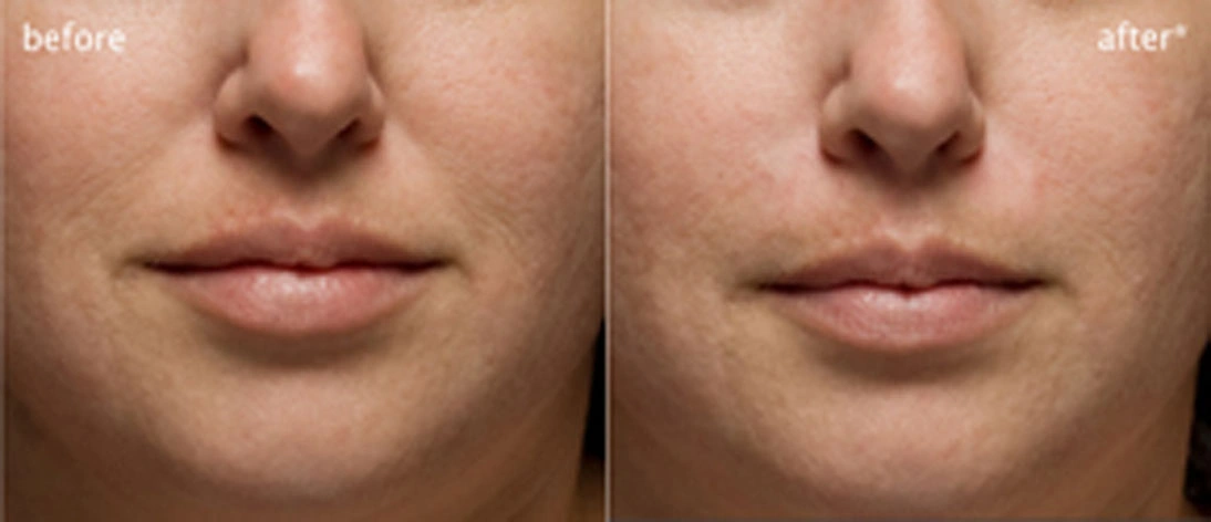 Real patient results before and after plastic surgery results in Glenview, IL, performed by Dr. Casas