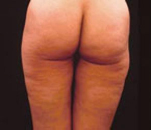 Real patient results before and after plastic surgery results in Glenview, IL, performed by Dr. Casas