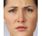 Real patient results before and after plastic surgery results in Glenview, IL, performed by Dr. Casas