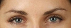 Real patient results before and after plastic surgery results in Glenview, IL, performed by Dr. Casas