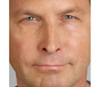 Real patient results before and after plastic surgery results in Glenview, IL, performed by Dr. Casas