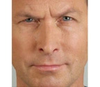 Real patient results before and after plastic surgery results in Glenview, IL, performed by Dr. Casas