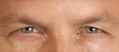 Real patient results before and after plastic surgery results in Glenview, IL, performed by Dr. Casas