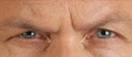 Real patient results before and after plastic surgery results in Glenview, IL, performed by Dr. Casas