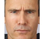 Real patient results before and after plastic surgery results in Glenview, IL, performed by Dr. Casas