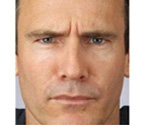 Real patient results before and after plastic surgery results in Glenview, IL, performed by Dr. Casas