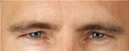 Real patient results before and after plastic surgery results in Glenview, IL, performed by Dr. Casas