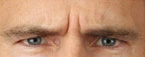 Real patient results before and after plastic surgery results in Glenview, IL, performed by Dr. Casas