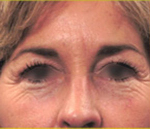 Real patient results before and after plastic surgery results in Glenview, IL, performed by Dr. Casas