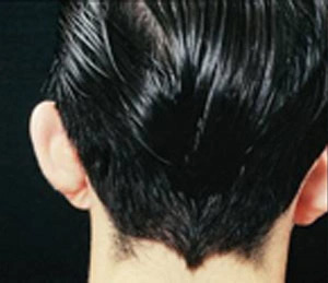 Real patient results before and after plastic surgery results in Glenview, IL, performed by Dr. Casas