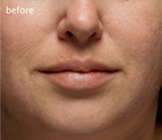 Real patient results before and after plastic surgery results in Glenview, IL, performed by Dr. Casas