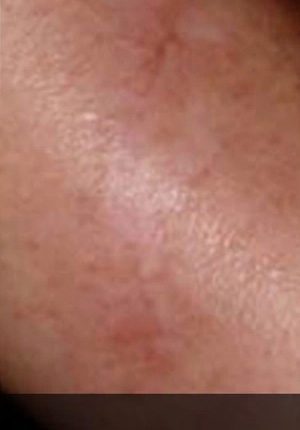 Real patient results before and after plastic surgery results in Glenview, IL, performed by Dr. Casas