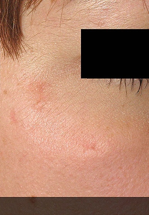 Real patient results before and after plastic surgery results in Glenview, IL, performed by Dr. Casas