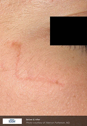 Real patient results before and after plastic surgery results in Glenview, IL, performed by Dr. Casas