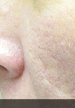 Real patient results before and after plastic surgery results in Glenview, IL, performed by Dr. Casas