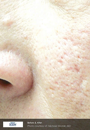 Real patient results before and after plastic surgery results in Glenview, IL, performed by Dr. Casas