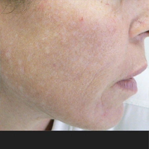 Real patient results before and after plastic surgery results in Glenview, IL, performed by Dr. Casas