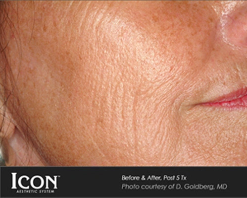Real patient results before and after plastic surgery results in Glenview, IL, performed by Dr. Casas