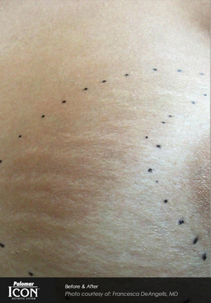 Real patient results before and after plastic surgery results in Glenview, IL, performed by Dr. Casas