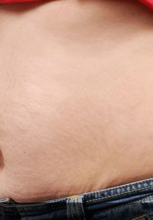 Real patient results before and after plastic surgery results in Glenview, IL, performed by Dr. Casas