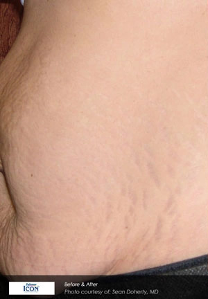 Real patient results before and after plastic surgery results in Glenview, IL, performed by Dr. Casas