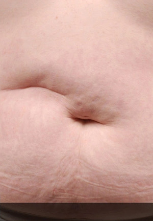 Real patient results before and after plastic surgery results in Glenview, IL, performed by Dr. Casas