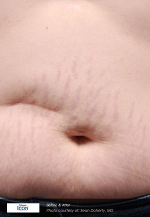 Real patient results before and after plastic surgery results in Glenview, IL, performed by Dr. Casas