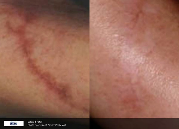 Real patient results before and after plastic surgery results in Glenview, IL, performed by Dr. Casas
