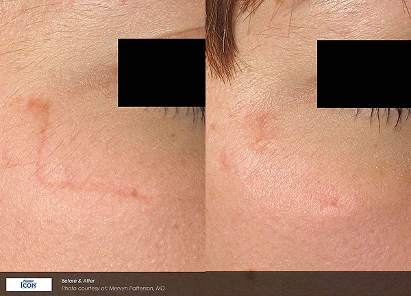 Real patient results before and after plastic surgery results in Glenview, IL, performed by Dr. Casas
