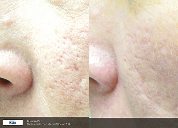Real patient results before and after plastic surgery results in Glenview, IL, performed by Dr. Casas