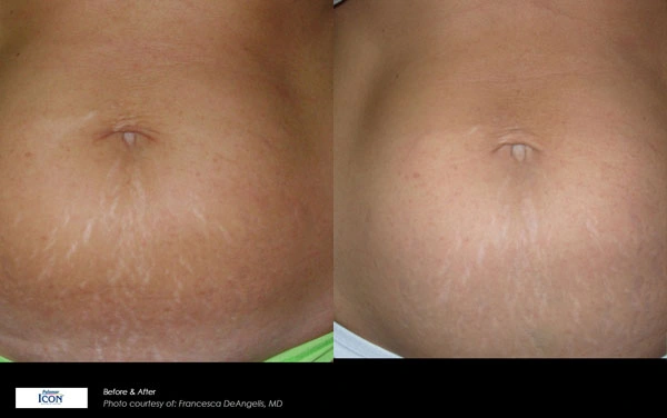 Real patient results before and after plastic surgery results in Glenview, IL, performed by Dr. Casas