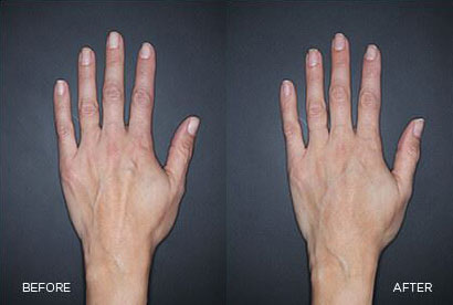 Real patient results before and after plastic surgery results in Glenview, IL, performed by Dr. Casas