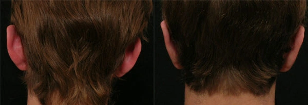 Real patient results before and after plastic surgery results in Glenview, IL, performed by Dr. Casas