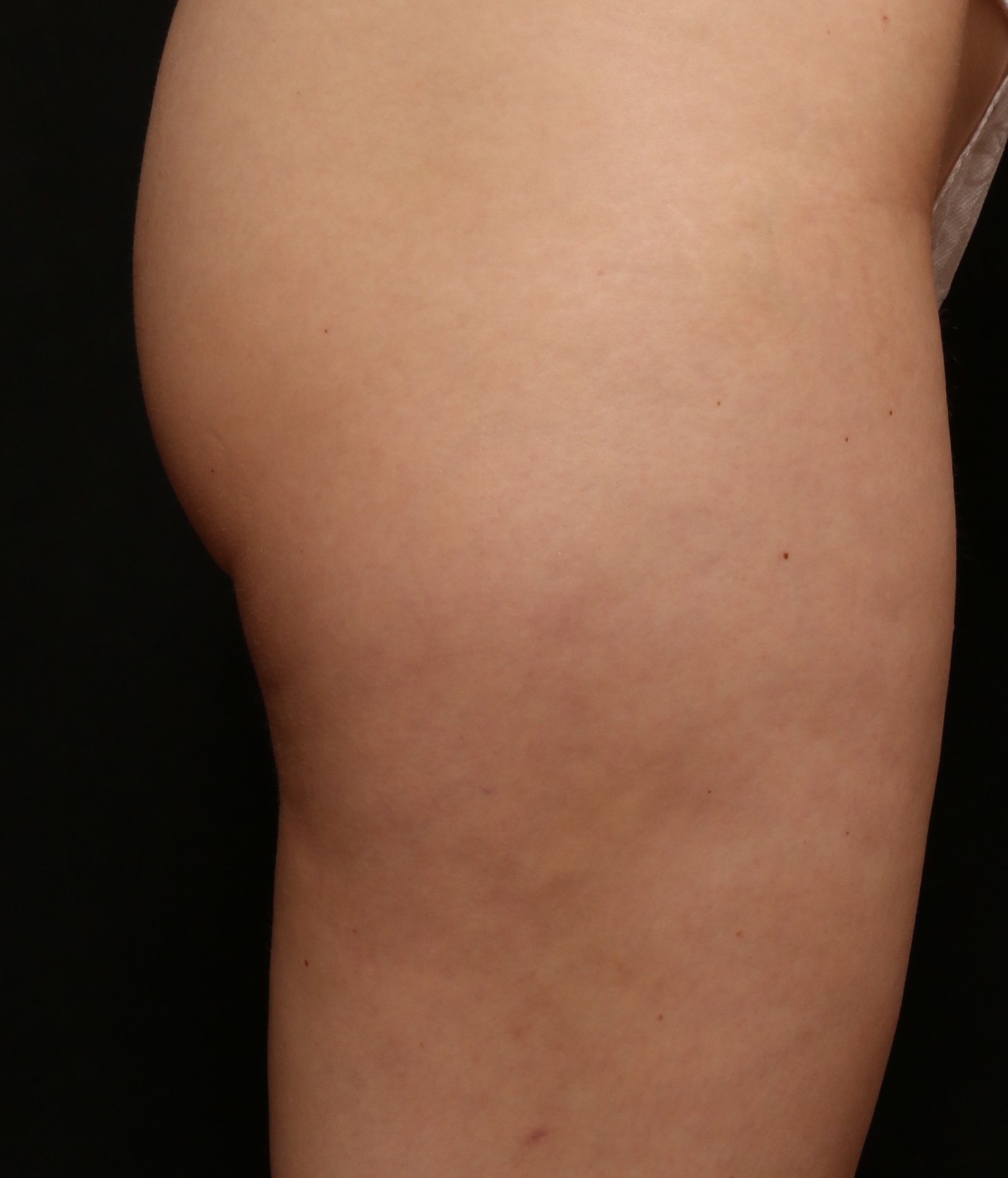 6 month post Avali (8)