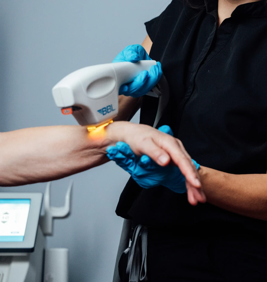 Medical professional performing laser treatment on patient's hand wearing blue gloves in clinical setting